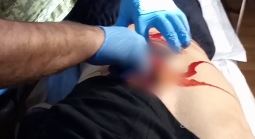 Военные медики группировки войск «Запад» провели сложнейшую операцию по извлечению взрывателя из мягких тканей спины военнослужащего